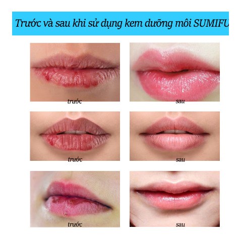 Kem Dưỡng Môi Giúp Dưỡng Ẩm Cho Môi, Cải Thiện Tình Trạng Khô, Nứt Nẻ, Giảm Thâm Sạm Môi,SUMIFUN Cheilitis Cream 20g,