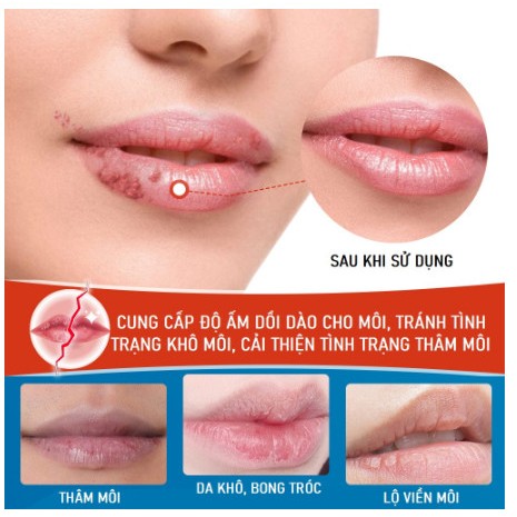 Kem Dưỡng Môi Giúp Dưỡng Ẩm Cho Môi, Cải Thiện Tình Trạng Khô, Nứt Nẻ, Giảm Thâm Sạm Môi,SUMIFUN Cheilitis Cream 20g,
