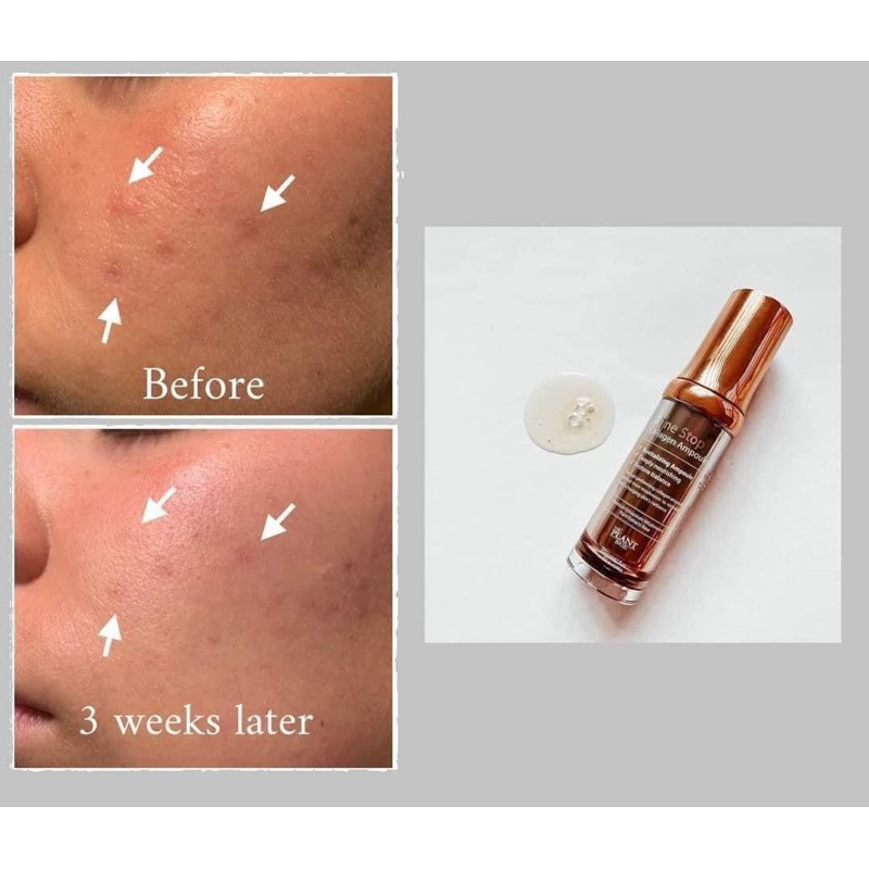 Tinh chất Collagen làm mờ nếp nhăn & độ đàn hồi da The Plant Base Time Stop Ampoule