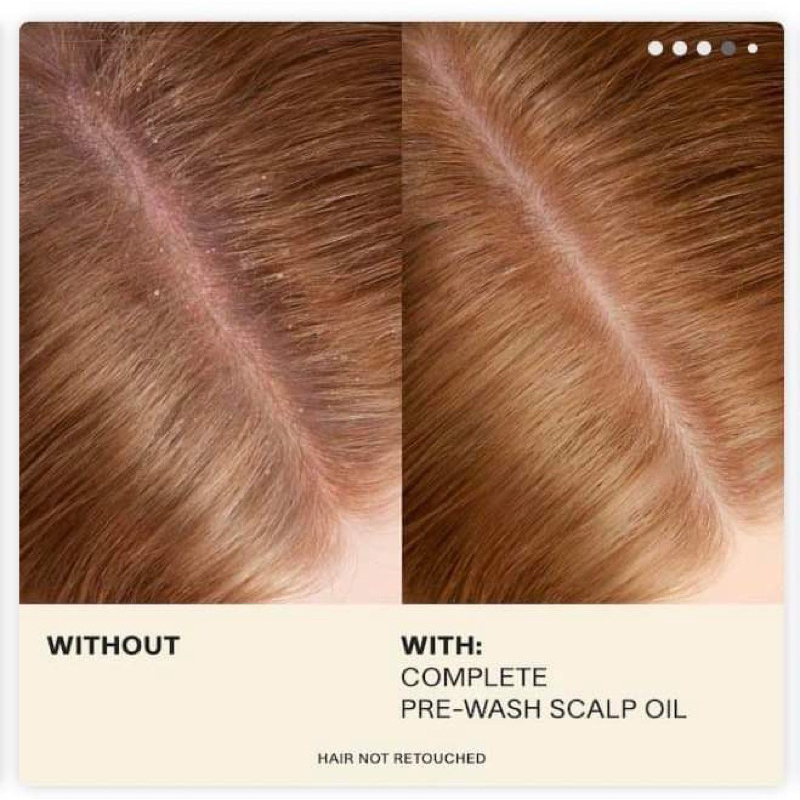 JVN dầu dưỡng tóc trước khi gội dầu Complete Pre-Wash Scalp & Hair Strengthening Treatment Oil