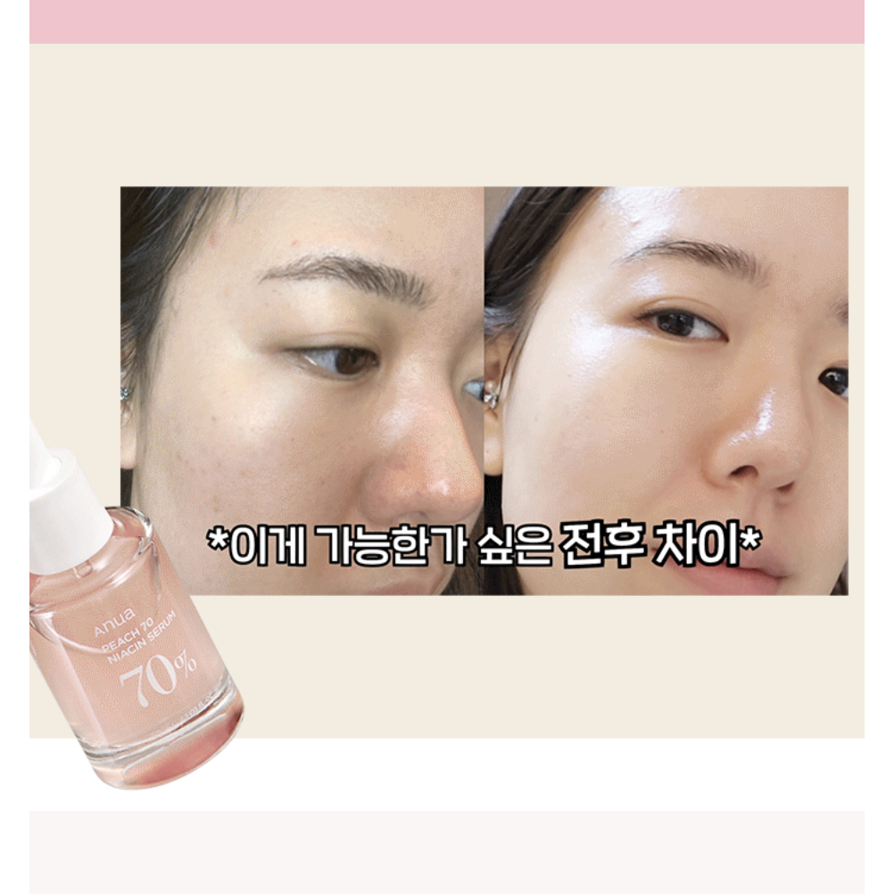 Tinh Chất Dưỡng Sáng 5% NIACINAMIDE ANUA PEACH 70 NIACIN SERUM 70% 30ML