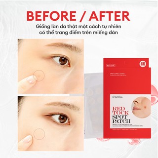 Miếng Dán Mụn So'Natural Red Tock Spot Patch (88 Patchs)