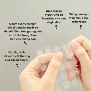 Miếng Dán Mụn So'Natural Red Tock Spot Patch (88 Patchs)