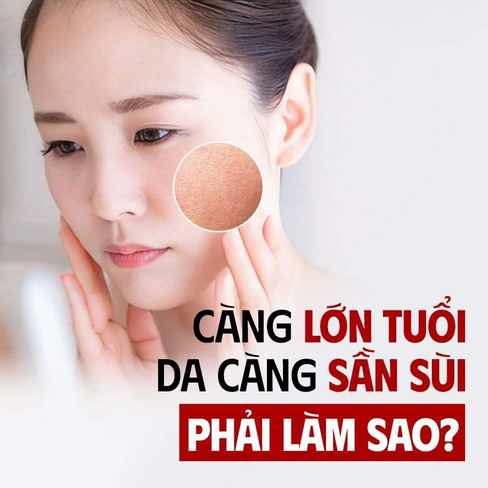 Serum So'Natural Red Peel Tingle Làm Giảm Mụn, Tái Tạo Làn Da 35ml