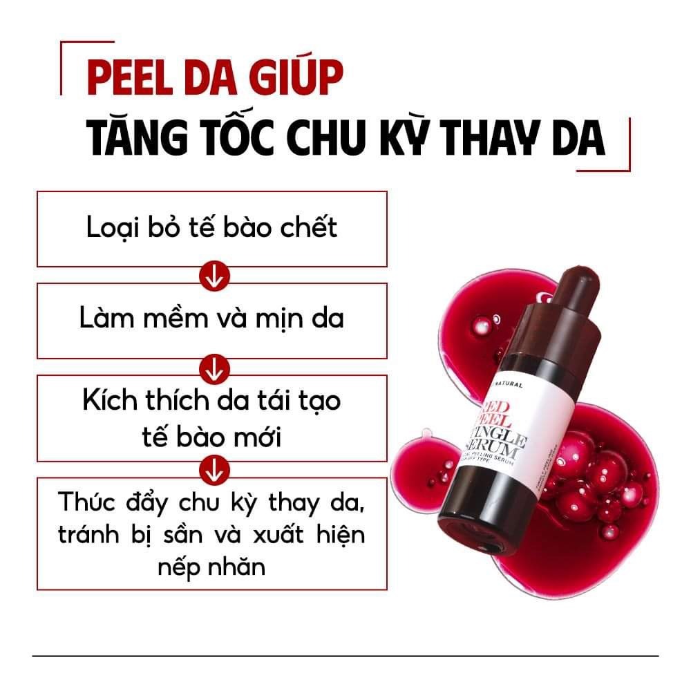 Serum So'Natural Red Peel Tingle Làm Giảm Mụn, Tái Tạo Làn Da 35ml
