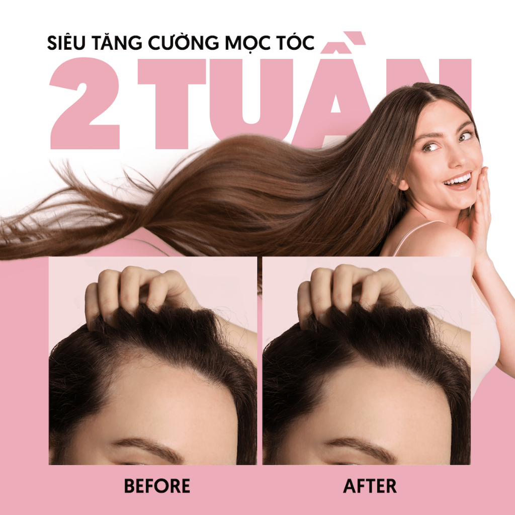 Xịt mọc tóc biotin & keratin 4% siêu tăng cường mọc tóc, làm dày tóc sau 3 tuần MILAGANICS 150ml (chai)