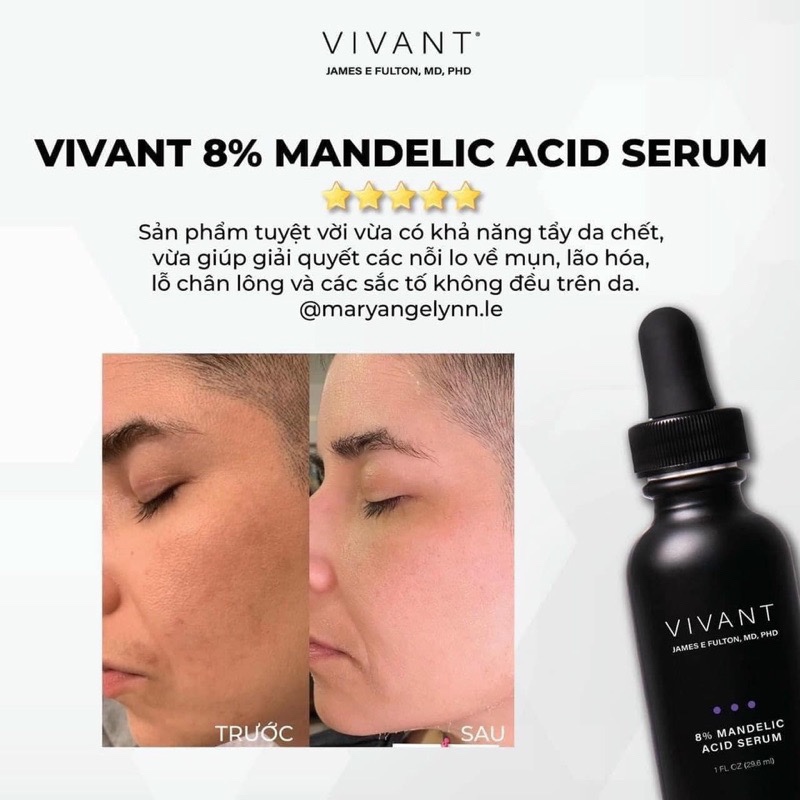 ￼ SERUM GIẢM MỤN, LÃO HOÁ, SẮC TỐ KHÔNG ĐỀU MÀU VIVANT SKINCARE 8% MANDELIC ACID 3-IN-1