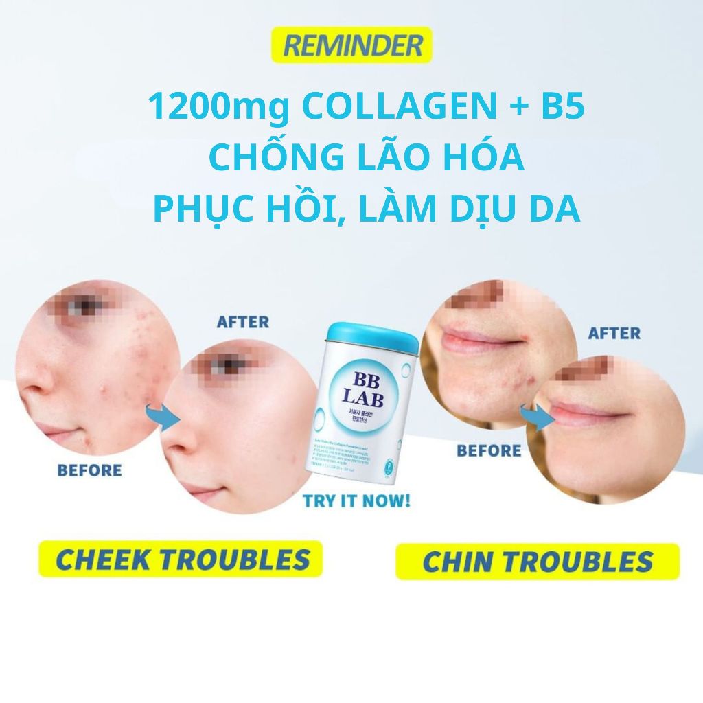 Combo 20 Gói Collagen Mix Vị Dứa + Dâu Da Căng Bóng, Chậm Lão Hóa