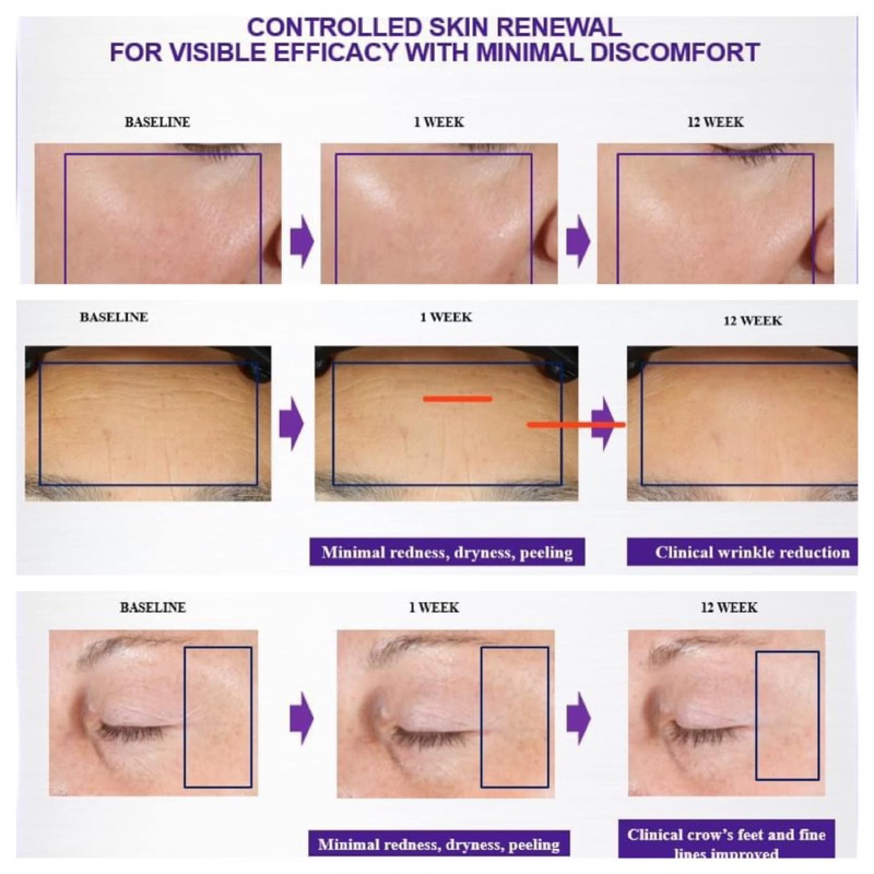 Tinh chất tái tạo da Kiehl’s Retinol Skin Renewing Daily Micro-Dose