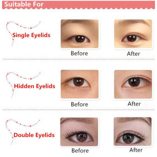 (CÓ BILL) Miếng Dán Kích Mí MISSHA Double Eyelid Tape 20 Miếng