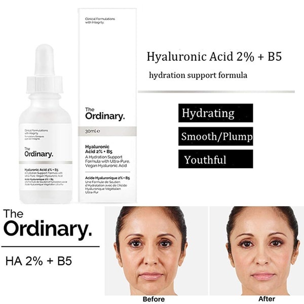Serum The Ordinary Hyaluronic Acid 2% + B5 cấp nước, phục hồi da dung tích 30ml