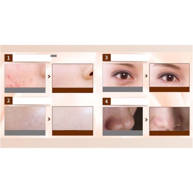 Kem Nền Trang Điểm Dưỡng Ẩm BB Cream Moisturing Lameila rửa mặt Winwinshop01