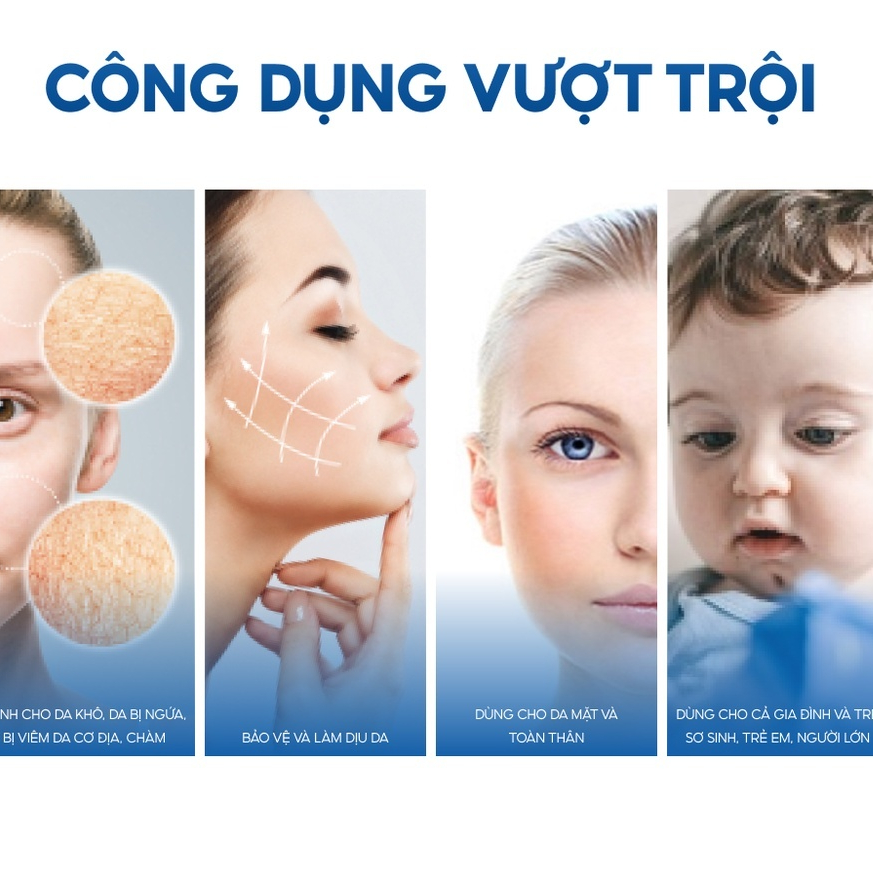 URIAGE Kem hỗ trợ điều trị da khô, viêm da cơ địa, chàm XÉMOSE CREME RELIPIDANTE ANTI-IRRITATIONS