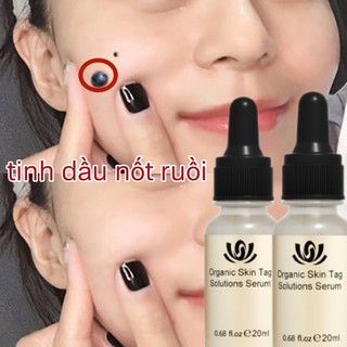 Tinh Chất Loại Bỏ Nốt Ruồi tẩy nốt ruồi mụn ruồi thịt Mole Removal Kem mụn cóc kem xóa nốt ruồ Gel