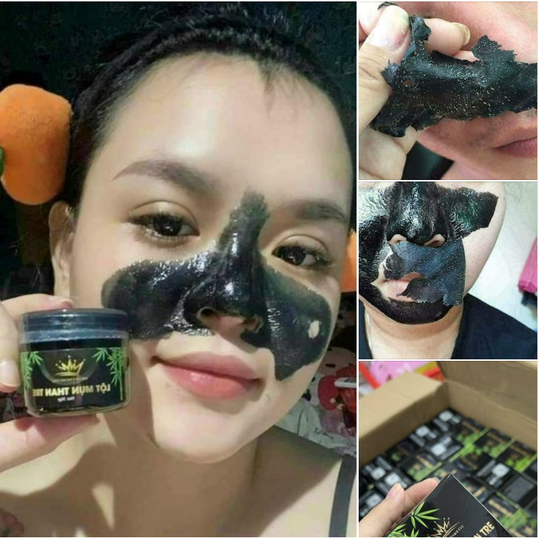 Lột Mụn Than Tre Pháp Cosmetic