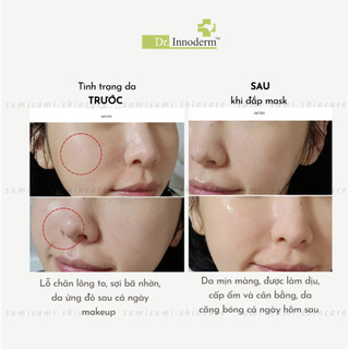SẴN (Dr.Innoderm) Mặt nạ tế bào gốc Multi Peptide Mask 40ml tinh chất