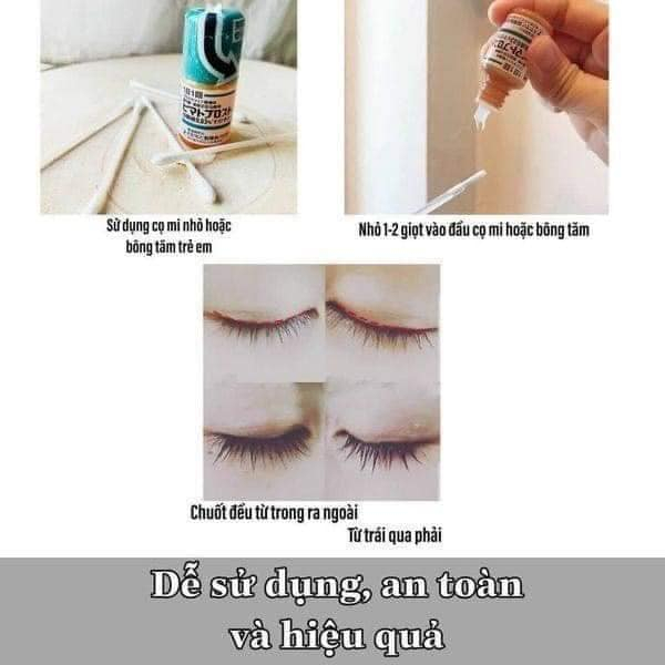 Dưỡng dài mi Bimatoprost Nhât