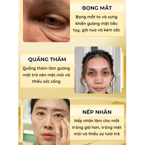 Mặt nạ tan bọng mắt CISU - CISU tan bọng mắt, mặt nạ giảm thâm quầng mắt, trẻ hóa da mắt, giúp đôi mắt tươi trẻ hiệu quả