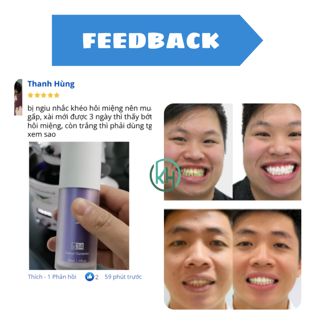 Tinh chất trắng răng VIVIAN, Serum trắng răng VIVIAN giúp trắng răng tự nhiên, an toàn, không gây ê buốt cho răng