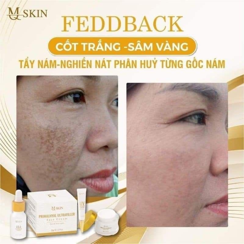 Bộ 4 món Kem Face Sâm Vàng MQ Skin chính hãng sỉ zalo 27x