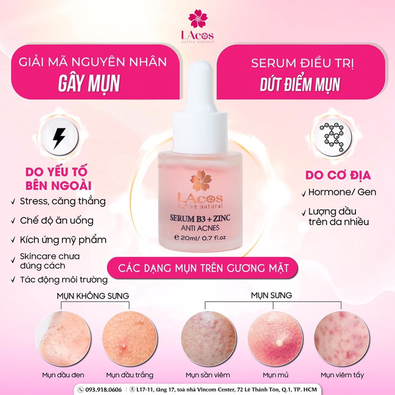 SERUM MỤN, Ngăn ngừa mụn