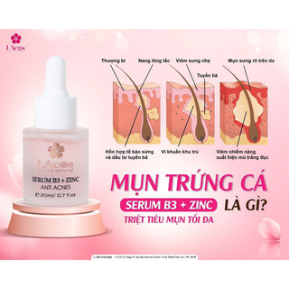 SERUM MỤN, Ngăn ngừa mụn