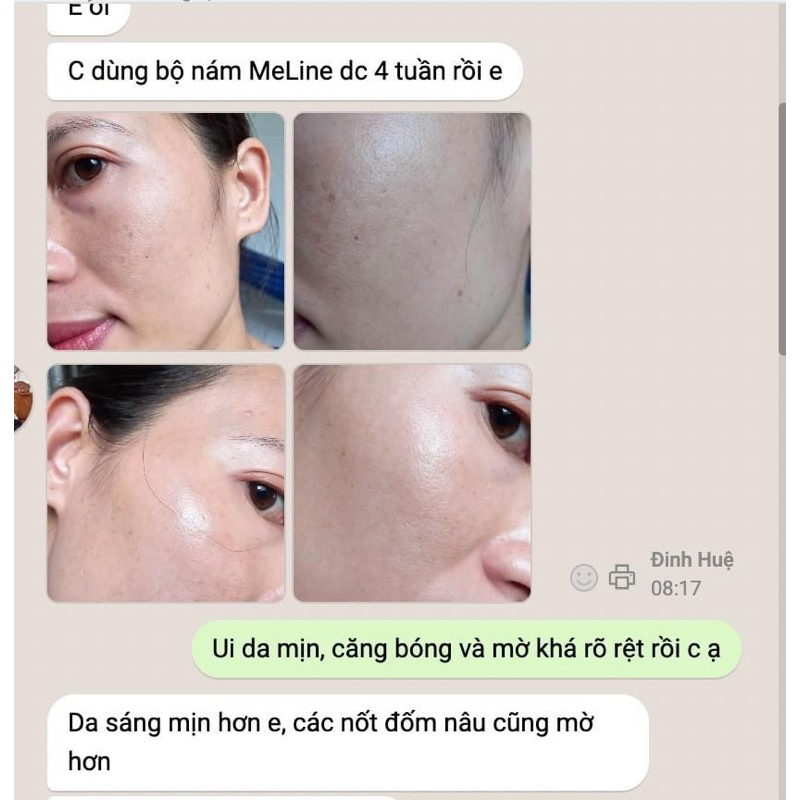 KEM GIẢM NÁM, PHÂN GIẢI SẮC TỐ MELINE 02 NIGHT CAUCASIAN SKIN 20G