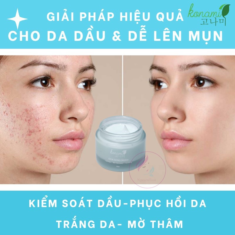 Combo sản phẩm chăm sóc da Serum , nước hoa hồng , kem dưỡng da Konami cica hàn quốc
