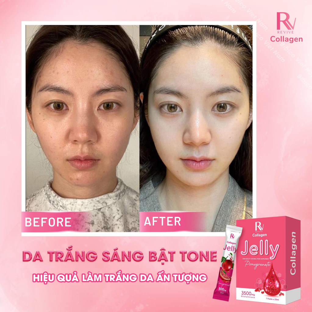 Thạch Collagen Trắng Da Thụy Sĩ, Thạch Lựu Collagen Jelly Pomegranate Dưỡng Trắng Da Toàn Thân Hộp 7 Gói
