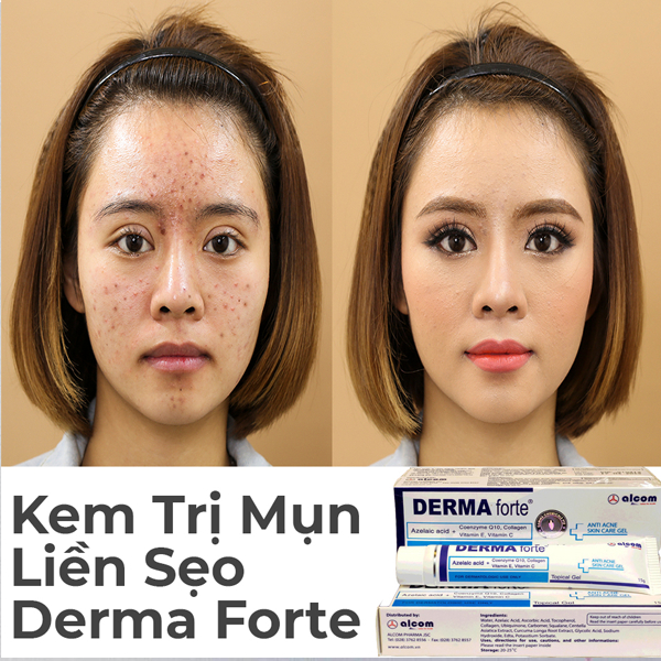 kem Mờ Thâm Mụn Gamma Derma Forte Giảm Sưng Đỏ 15g