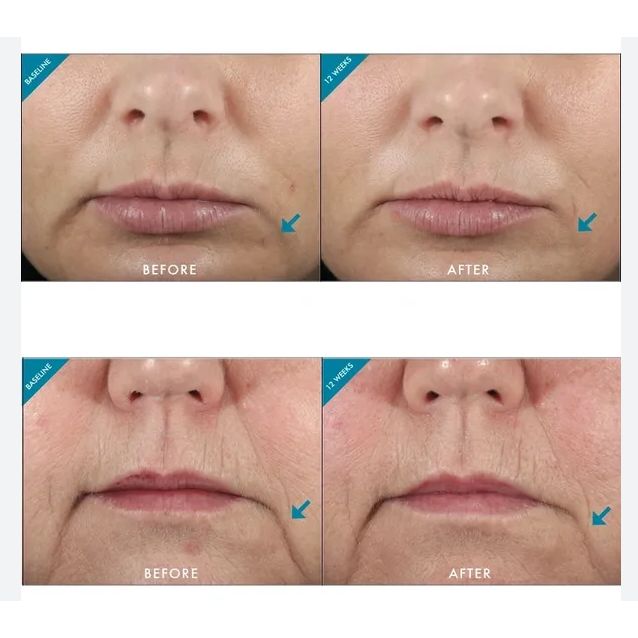 Collagen Dạng Nước Giúp Da Ẩm Mượt Căng Bóng, Sáng Da, Chống Lão Hóa Số 1 tại Đức Elasten Collagen