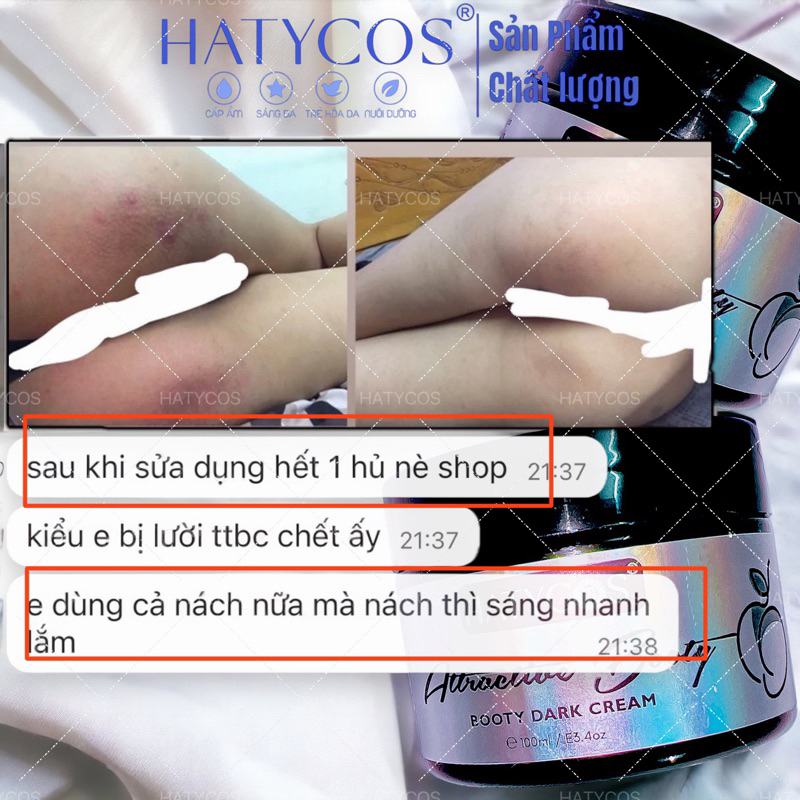 Kem Siêu Dưỡng Trắng Mông HATYCOS Duỡng ẫm Mờ Thâm mông Bẹn , Khuỷ tay và chân