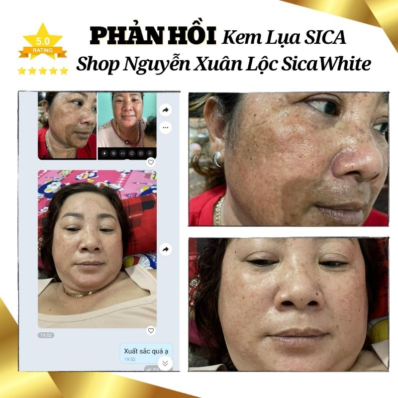 Kem Dưỡng TRẮNG - Mờ THÂM NÁM - Phục hồi da - MINI 6g  và FULL 25g - Chính Hãng Sica White