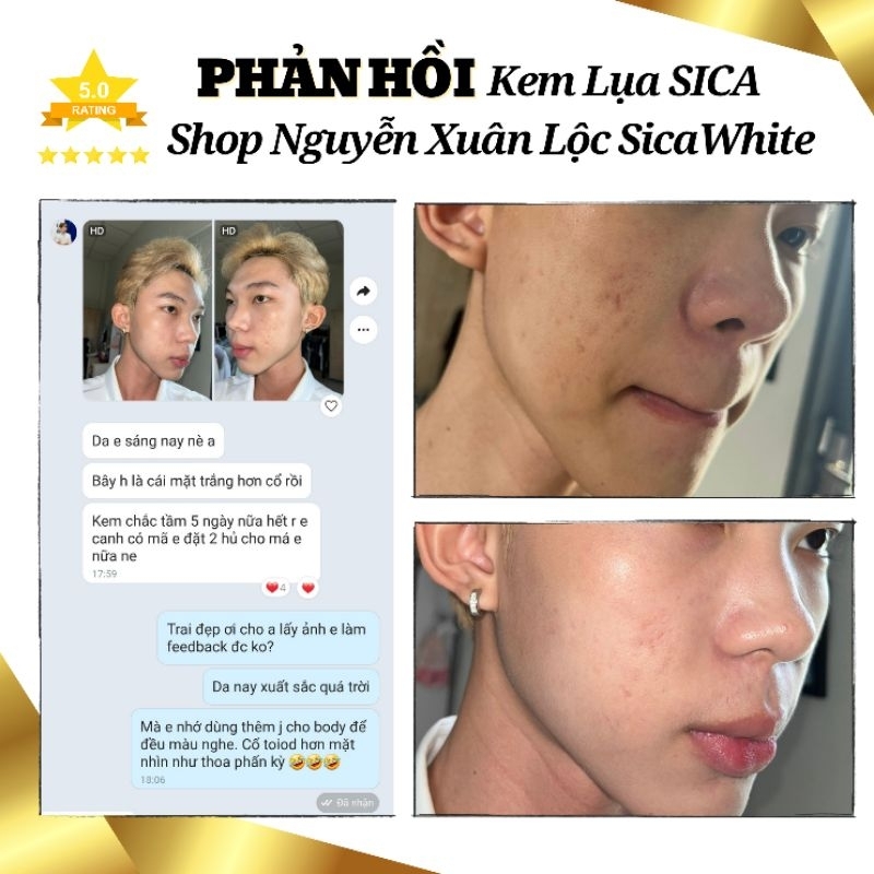Kem Dưỡng TRẮNG - Mờ THÂM NÁM - Phục hồi da - MINI 6g  và FULL 25g - Chính Hãng Sica White