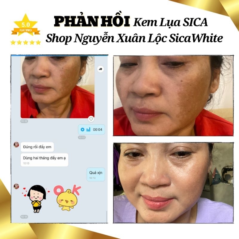 Kem Dưỡng TRẮNG - Mờ THÂM NÁM - Phục hồi da - MINI 6g  và FULL 25g - Chính Hãng Sica White