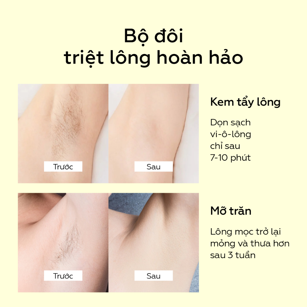 Bộ sản phẩm triệt lông body vĩnh viễn tại nhà chuẩn spa UMIHA thay cho máy triệt lông, tiện lợi, dễ dàng sử dụng