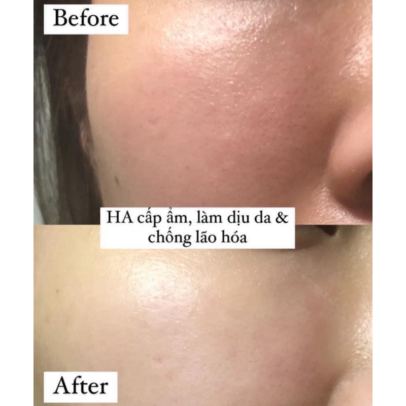 Serum ban đêm giúp nâng cơ, trắng da. Hàng mua tại Pháp