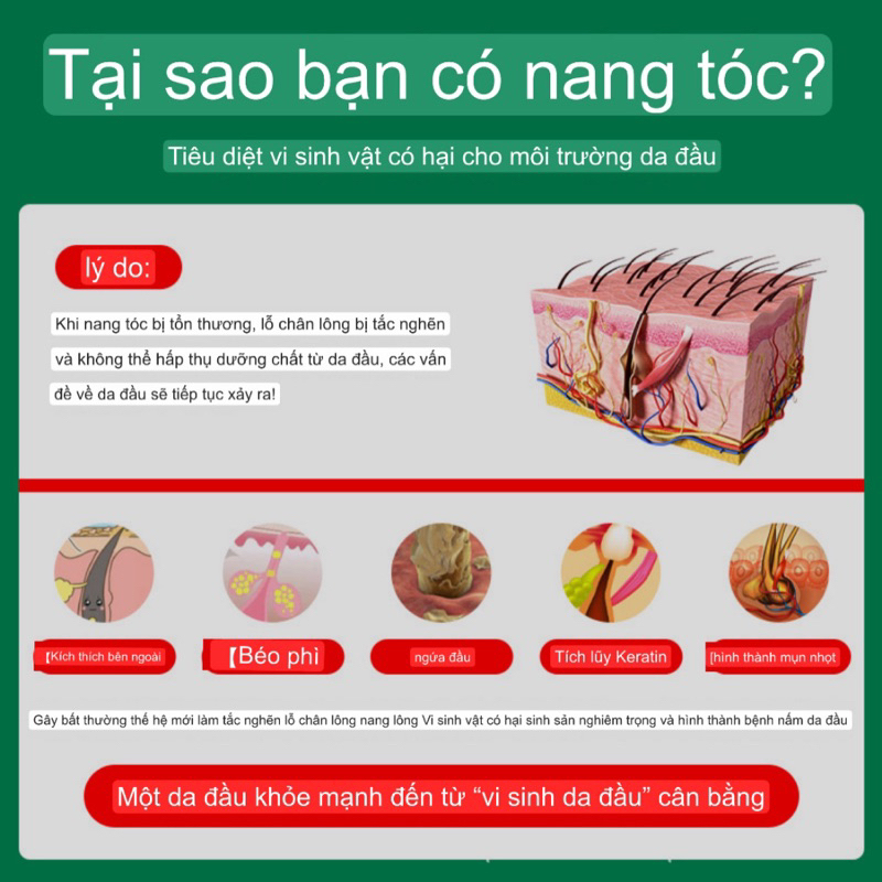 Kem viêm nang lông, á sừng, đông y Trung Quốc