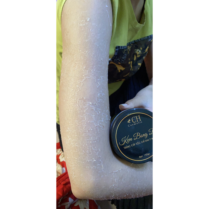 Kem bong da body loại bỏ da chết