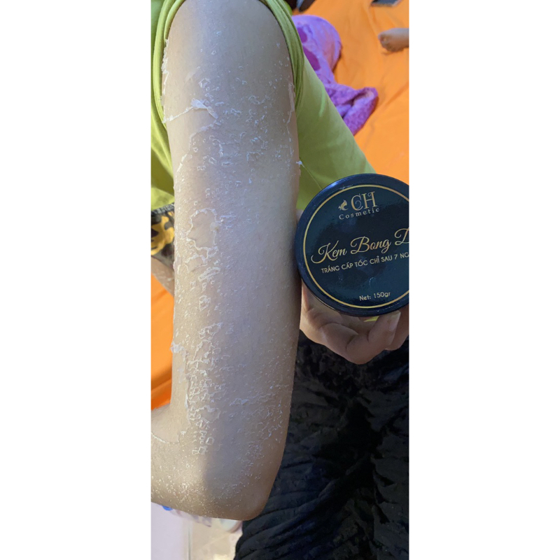 Kem bong da body loại bỏ da chết