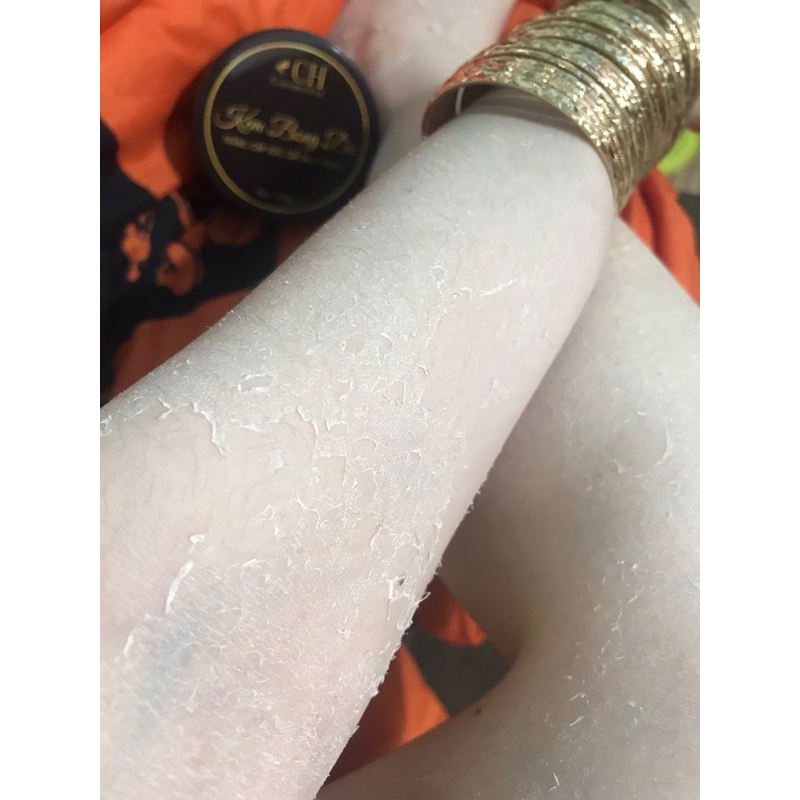 Kem bong da body loại bỏ da chết