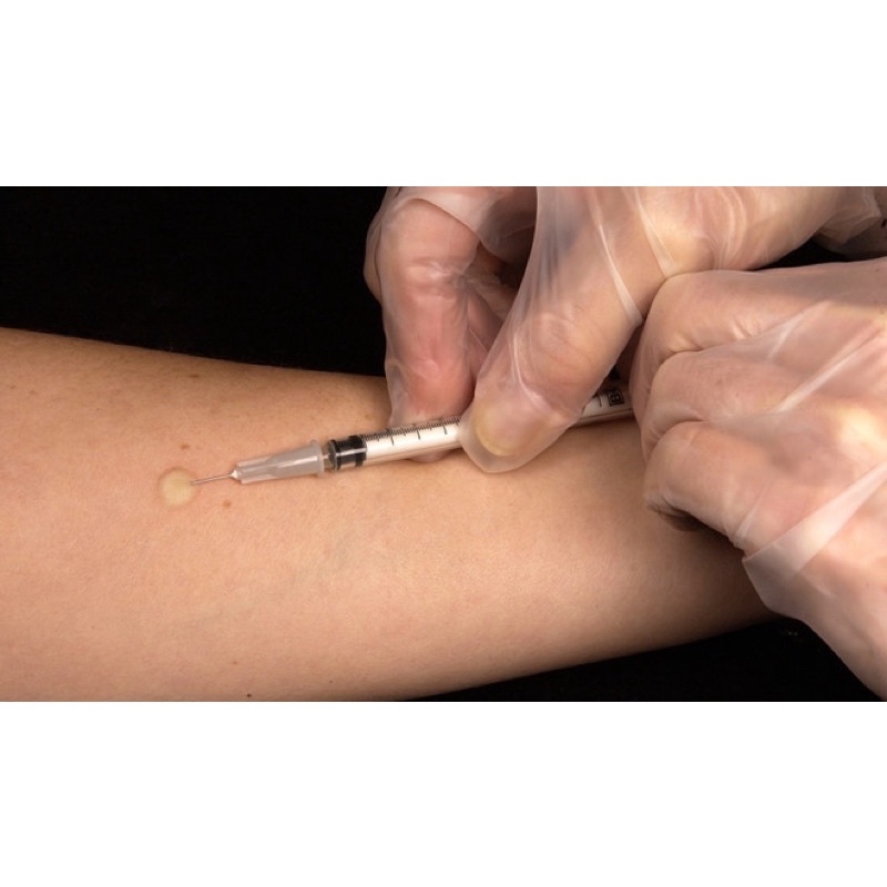 Nisanolona Tiên Tan Sẹo Lồi , Hàng Nhập Khẩu Ý