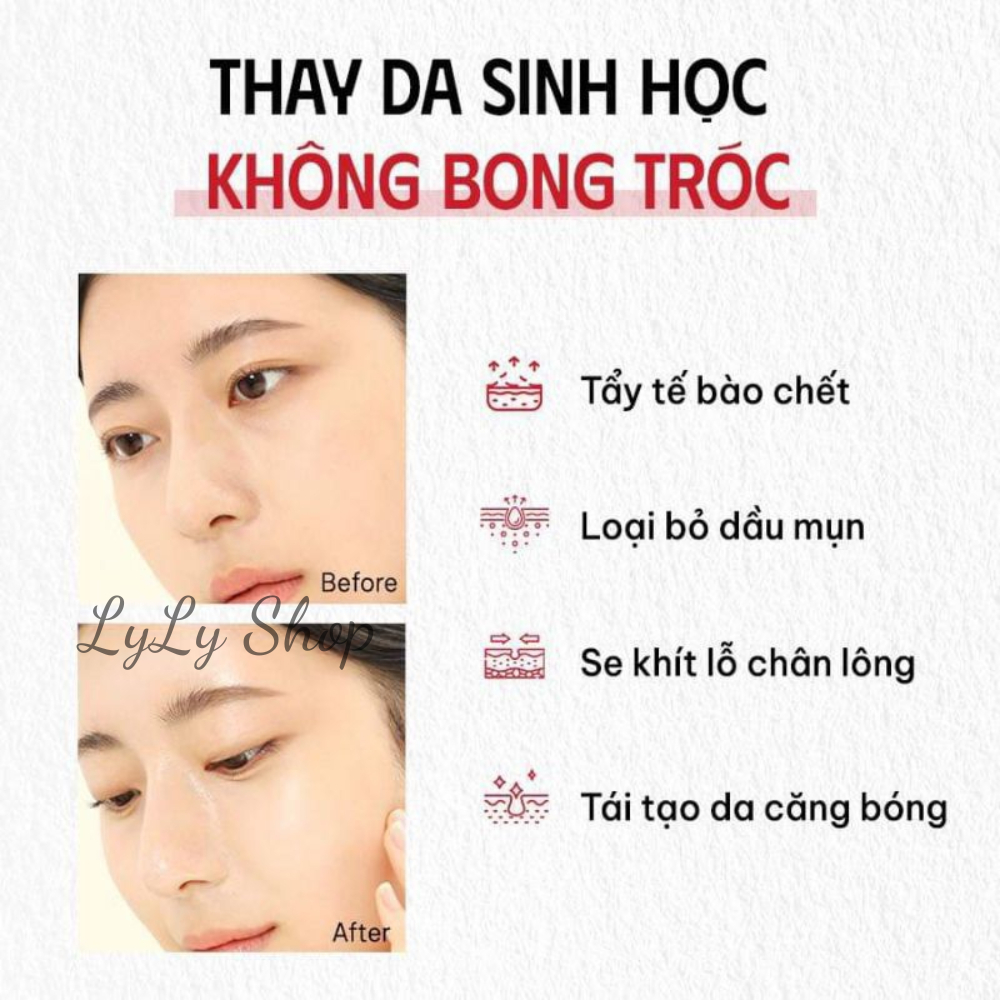 Peel Da Red Tingle So'Natural, Serum tẩy tế bào chết, tái tạo da sinh học, cân bằng độ ẩm cho da Lylyshop 11ml