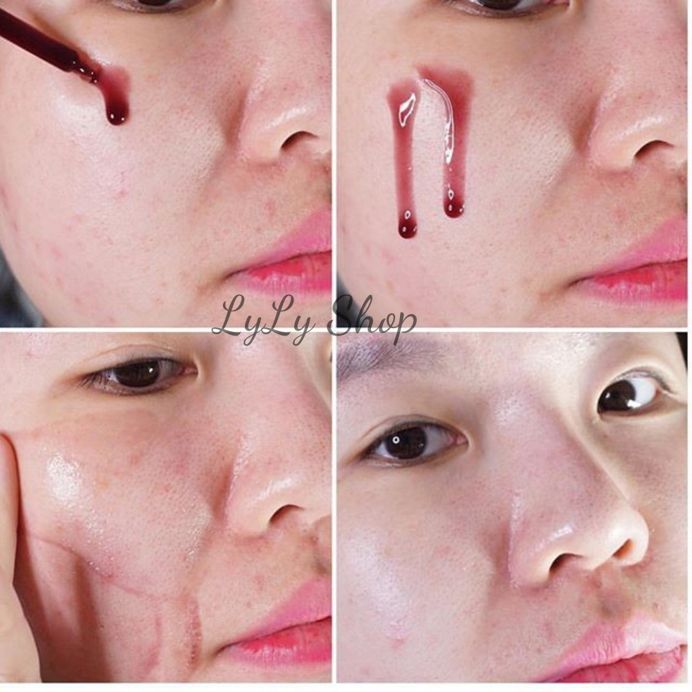 Peel Da Red Tingle So'Natural, Serum tẩy tế bào chết, tái tạo da sinh học, cân bằng độ ẩm cho da Lylyshop 11ml
