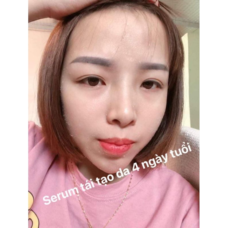 Peel nám đa tầng doctor queen