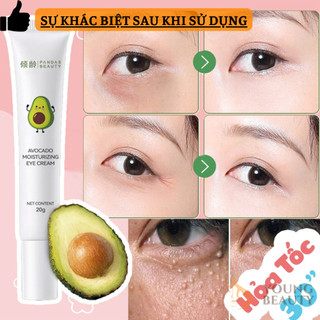 Kem mụn thịt, kem bơ tẩy mụn thịt quanh mắt, dưỡng mờ nếp nhăn, giảm thâm quầng mắt chính hãng