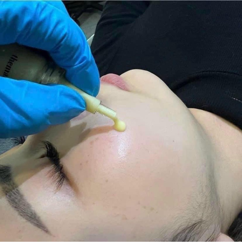 TINH CHẤT MESO THERAPY SIÊU CĂNG BÓNG TRẮNG MỊN TRẺ HOÁ DA CẤP TẾ BÀO