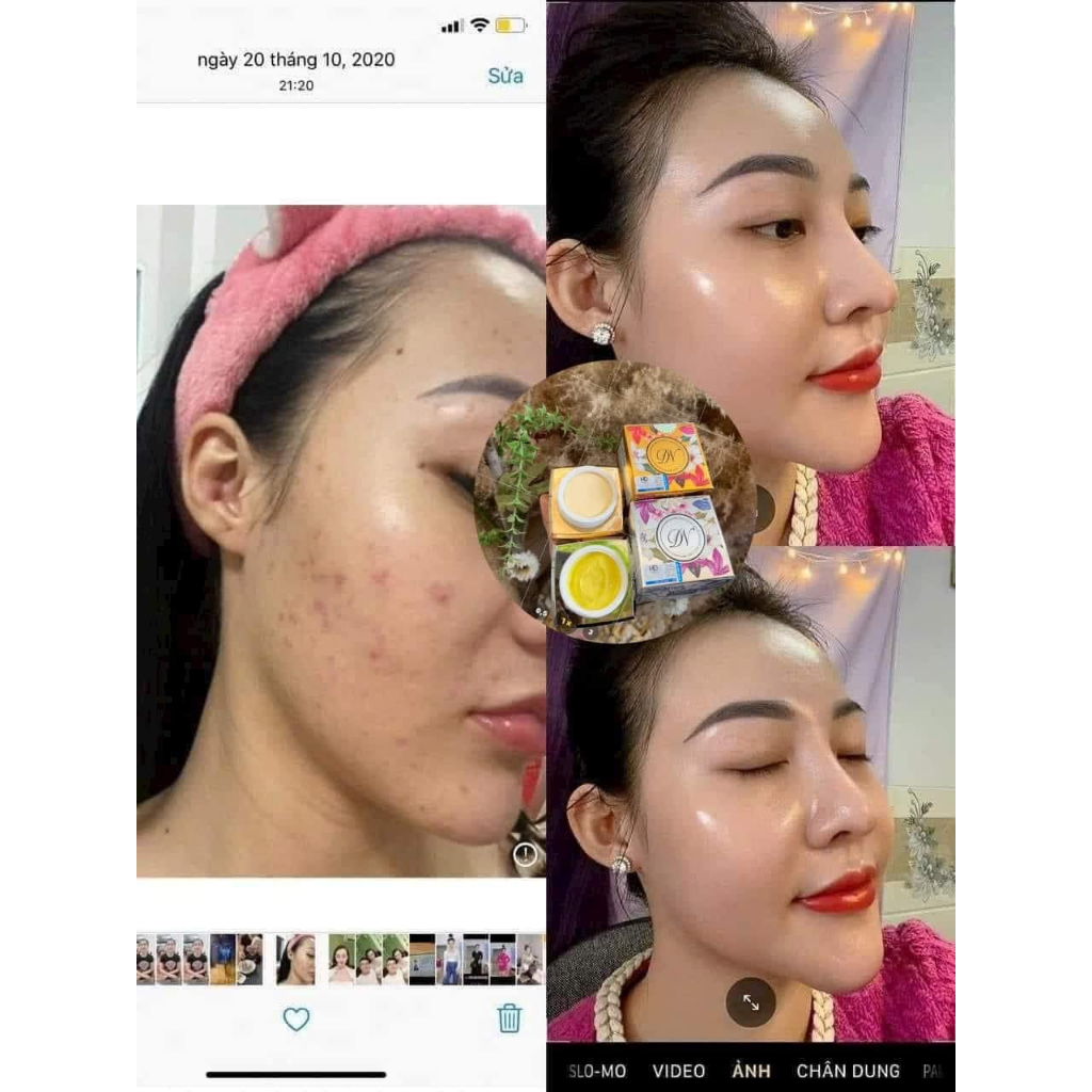 Kem Dưỡng trắng da 𝐃𝐄𝐌𝐄𝐉𝐈𝐍𝐄 tái tạo da, se khít lỗ chân lông