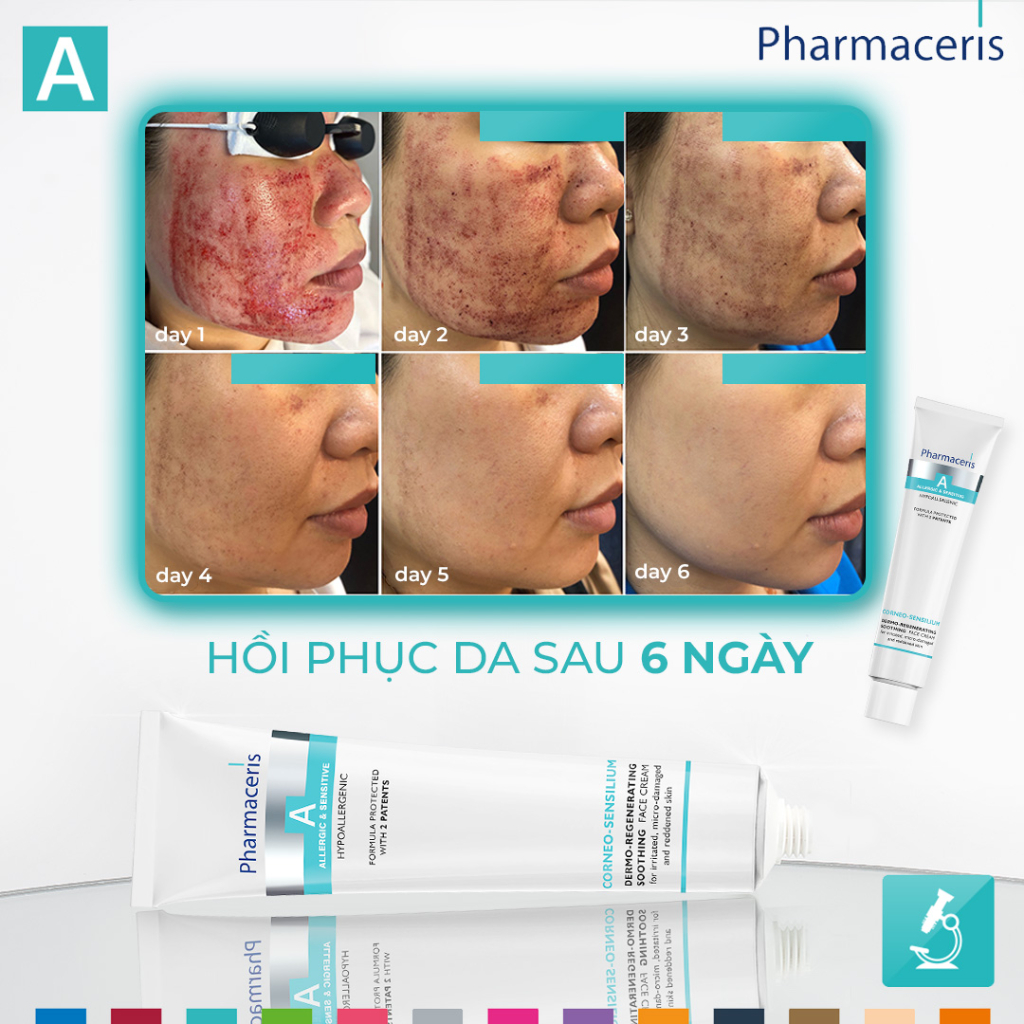 Pharmaceris Corneo-Sensilium - Kem dưỡng phục hồi da nhạy cảm 75ml