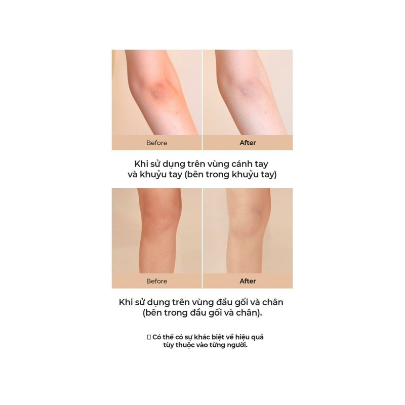 Kem dưỡng trắng da và chống lão hóa body The Bright Up Body Cream 500ml